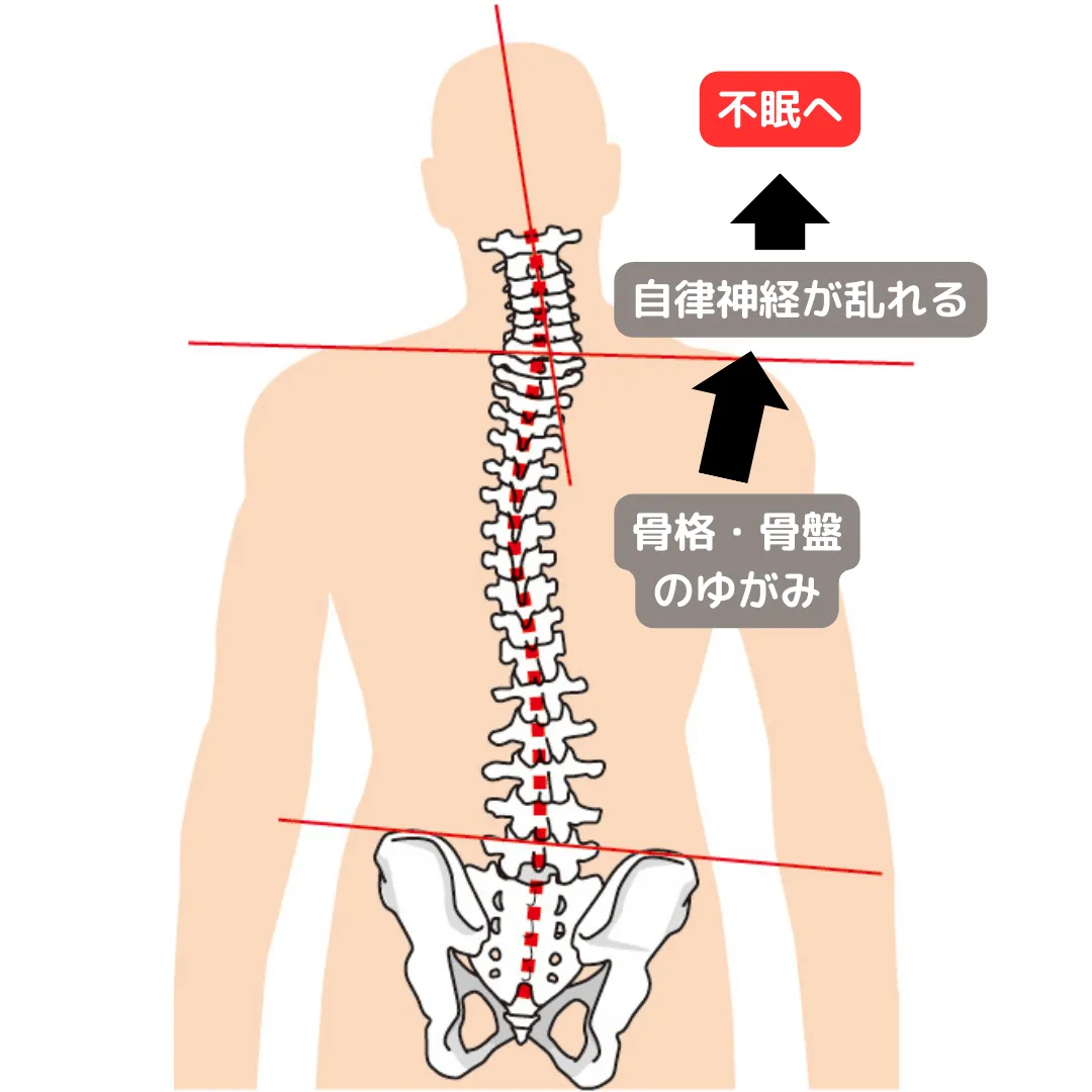 不眠症の原因