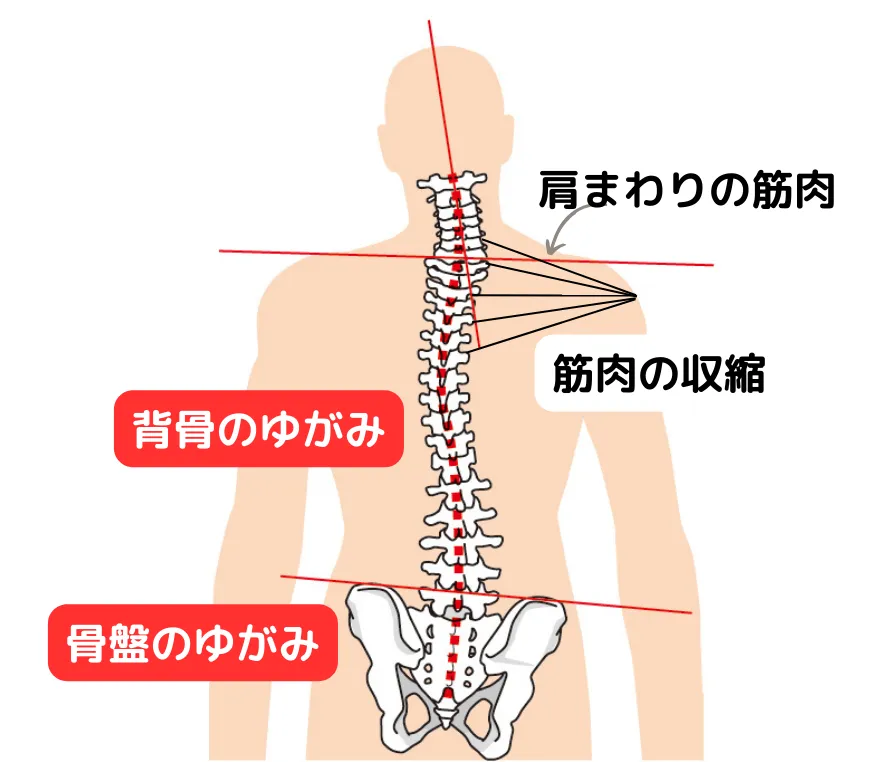 肩こりのメカニズムにおける説明図