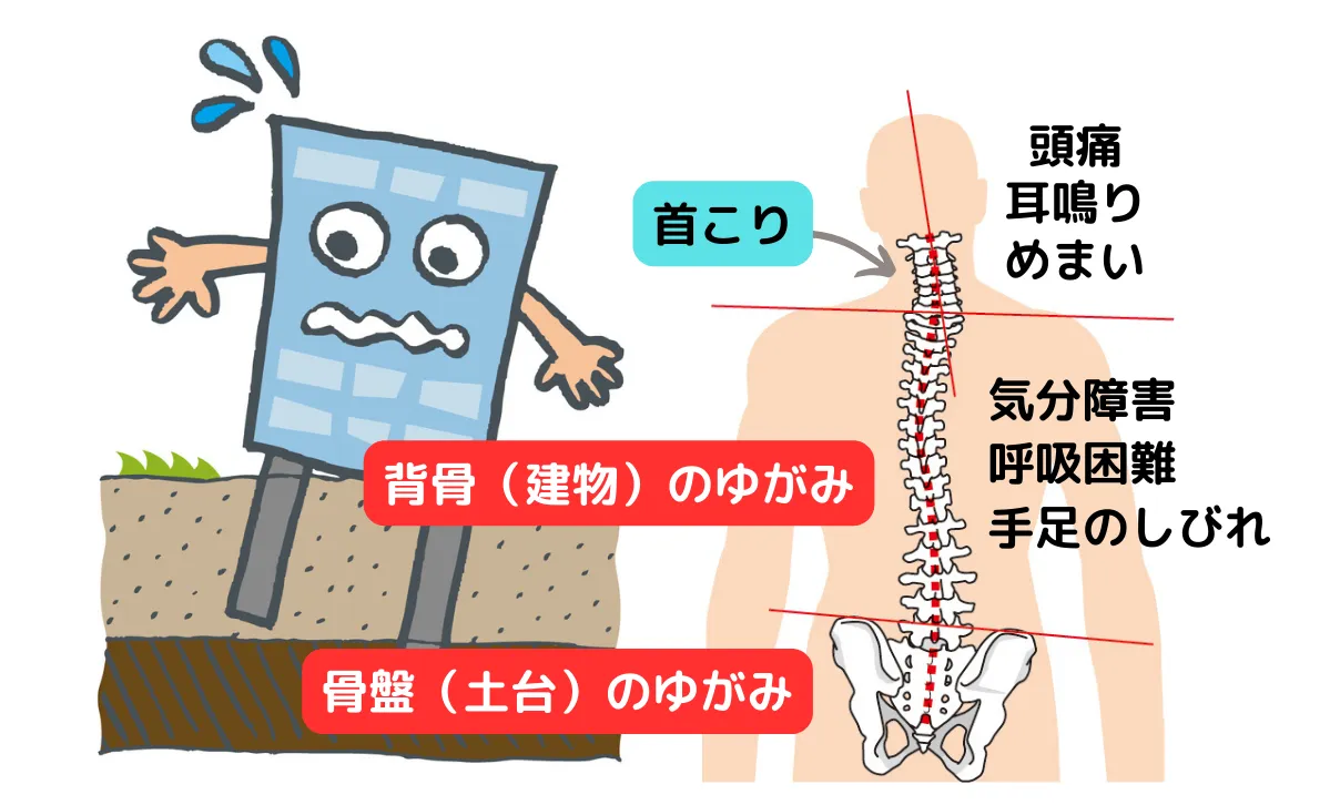 首こりのメカニズムにおける説明図